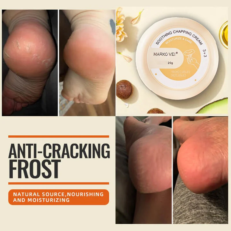 ☃️Christmas Hot Sale-50% OFF🔥Winter Anti-Cracking Frost