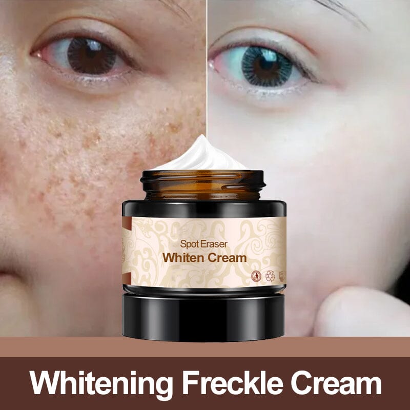 Plant lightening melanin freckle cream