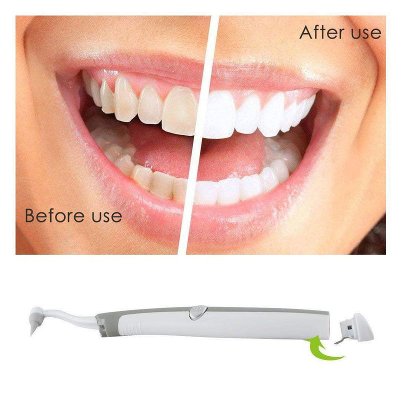 3 In 1 Teeth Cleaning Tools Kit With LED Light